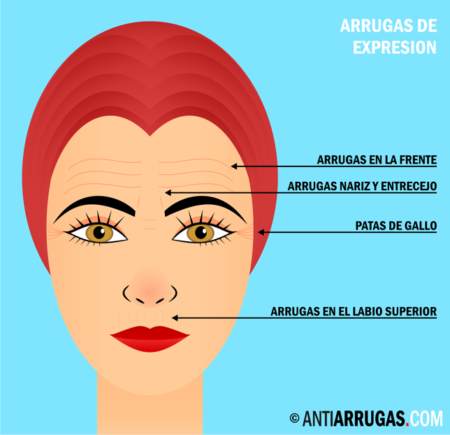 arrugas de expresion