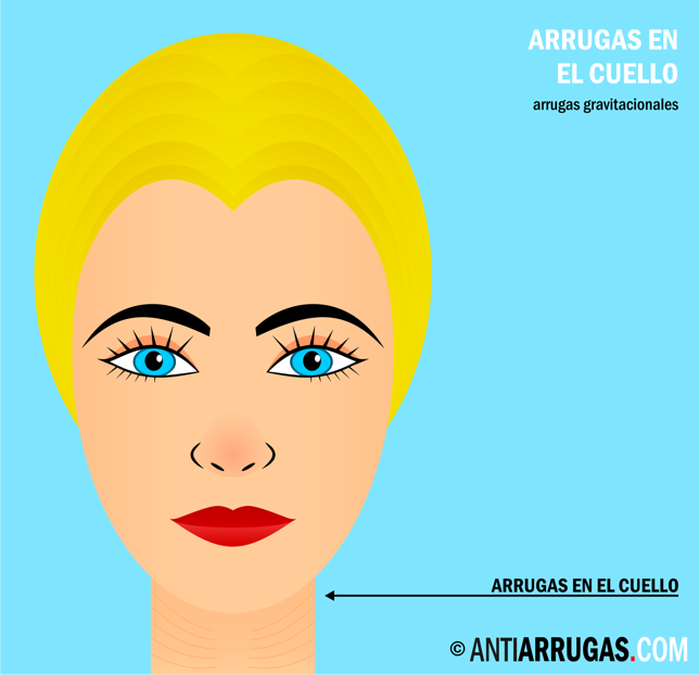 arrugas en el cuello